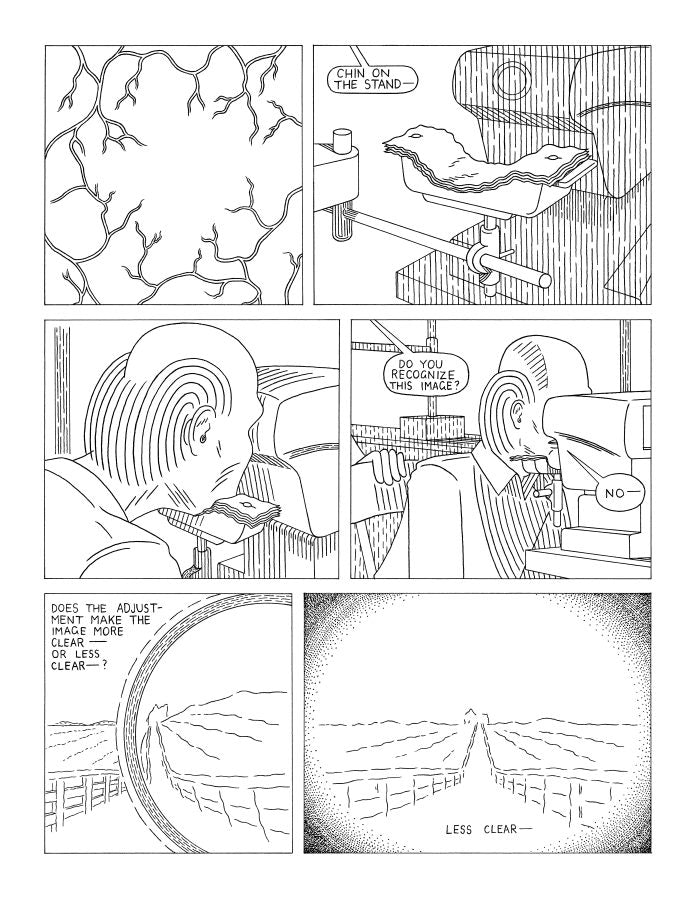 Laser Eye Surgery